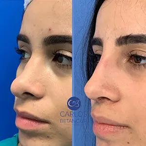 Img-cirujano-plastico-medellin-BannerHome-2025-Procedimiento