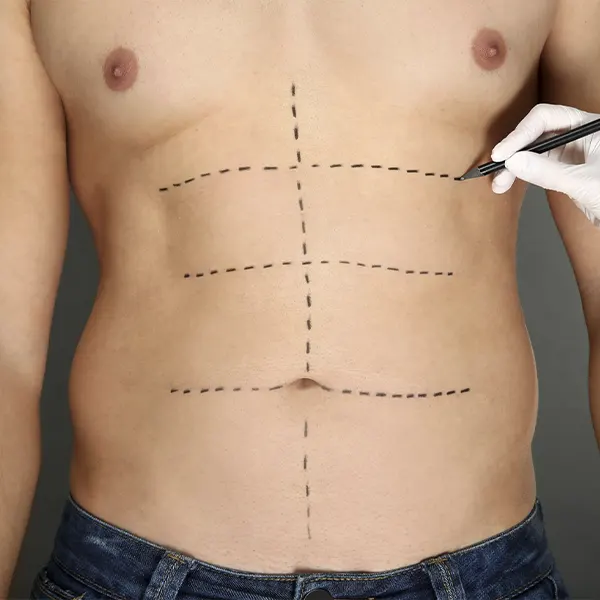 Img-cirujano-plastico-medellin-CirugiaMasculina-2025