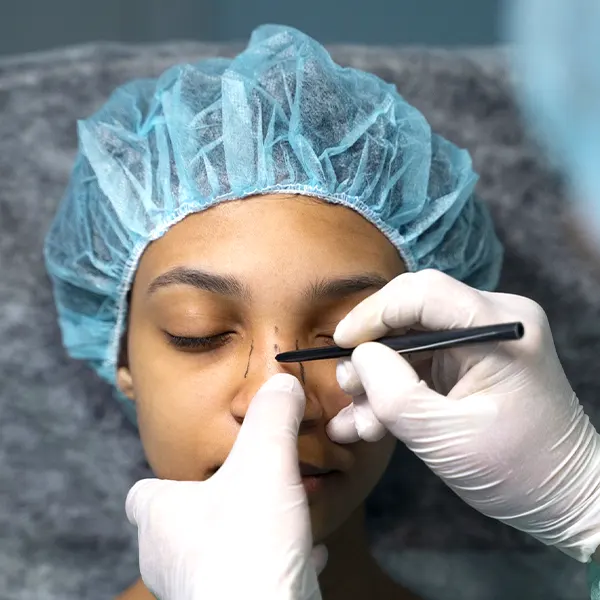 Img-cirujano-plastico-medellin-Rinoplastia-2025