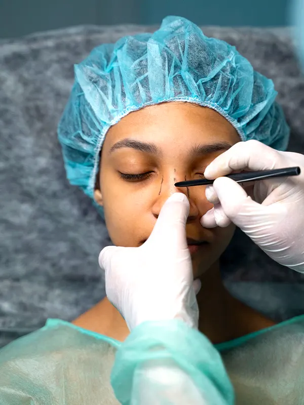 img-rinoplastia-medellin-1